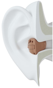 Hearing-Aid-Type-4-In the Canal